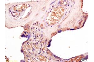 Formalin-fixed and paraffin embedded human placenta labeled with Rabbit Anti TLR3 Polyclonal Antibody, Unconjugated (ABIN686617) at 1:200 followed by conjugation to the secondary antibody and DAB staining (TLR3 antibody  (AA 801-905))