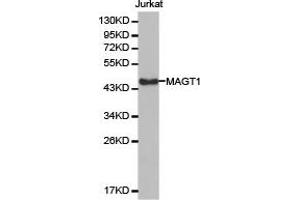 Western Blotting (WB) image for anti-Magnesium Transporter 1 (MAGT1) antibody (ABIN1876277) (MAGT1 antibody)