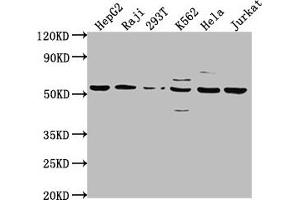 Western Blot Positive WB detected in: HepG2 whole cell lysate, Raji whole cell lysate, 293T whole cell lysate, K562 whole cell lysate, Hela whole cell lysate, Jurkat whole cell lysate All lanes: CAP1 antibody at 1:2000 Secondary Goat polyclonal to rabbit IgG at 1/50000 dilution Predicted band size: 52 kDa Observed band size: 52 kDa (CAP1 antibody  (AA 22-157))