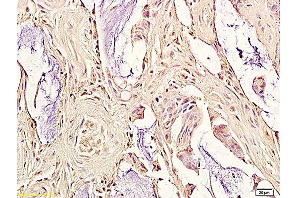 OxLDL antibody