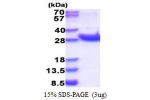 SDS-PAGE (SDS) image for Protein tyrosine Phosphatase, Receptor Type, C (PTPRC) (AA 1031-1251) protein (His tag) (ABIN6387391) (CD45 Protein (AA 1031-1251) (His tag))