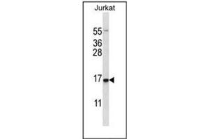 Western blot analysis of GADD153 / CHOP Antibody  in Jurkat cell line lysates (35ug/lane). (DDIT3 antibody  (Middle Region))