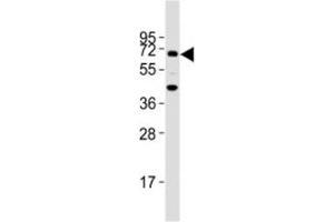 Western blot testing of TGFBR2 antibody at 1:2000 dilution + mouse lung lysate; Predicted molecular weight ~ 65 kDa.