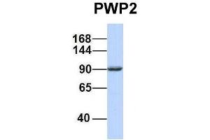 Host:  Rabbit  Target Name:  PWP2  Sample Type:  721_B  Antibody Dilution:  1. (PWP2 antibody  (Middle Region))
