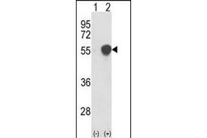 Western blot analysis of PHGDH (arrow) using rabbit polyclonal PHGDH Antibody (N-term) (ABIN389483 and ABIN2839543).