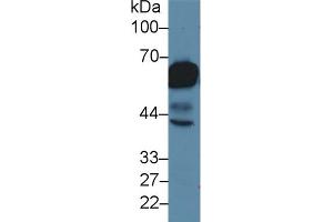 Detection of CK5 in Rat Tongue lysate using Polyclonal Antibody to Cytokeratin 5 (CK5) (Cytokeratin 5 antibody  (AA 163-471))