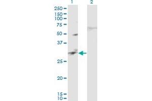 Western Blot analysis of CAPS2 expression in transfected 293T cell line by CAPS2 monoclonal antibody (M02), clone 3C6.