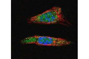 Confocal immunofluorescent analysis of SUMO1 antibody with A375 cells followed by Alexa Fluor 488-conjugated goat anti-rabbit lgG (green). (SUMO1 antibody  (AA 1-30))