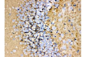 Anti-GAP43 antibody, IHC(P) IHC(P): Rat Brain Tissue (GAP43 antibody  (C-Term))