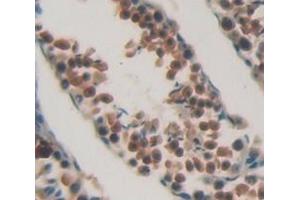 Figure. (CHEK1 antibody  (AA 194-446))