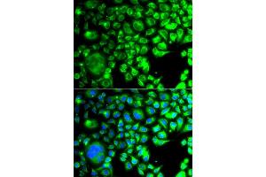 Immunofluorescence analysis of A549 cell using TBPL1 antibody. (TBPL1 antibody)