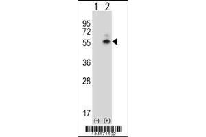 Western blot analysis of Camk2d using rabbit polyclonal Mouse Camk2d Antibody using 293 cell lysates (2 ug/lane) either nontransfected (Lane 1) or transiently transfected (Lane 2) with the Camk2d gene. (CAMK2D antibody  (AA 221-250))