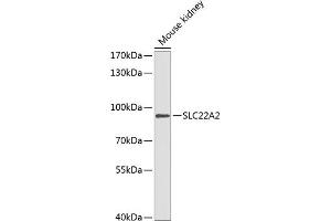 Western blot analysis of extracts of mouse kidney, using SLC22 antibody (ABIN6129479, ABIN6147886, ABIN6147888 and ABIN6218288) at 1:1000 dilution. (SLC22A2 antibody  (AA 44-140))