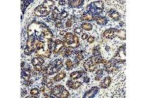 IHC analysis of Synip/STXBP4 using anti-Synip/STXBP4 antibody (ABIN7602066). (STXBP4 antibody  (AA 57-481))