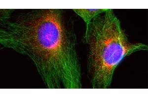 Indirect immunofluorescence on 3T3 cells (dilution 1 : 100; red) in combination with the monoclonal antibody against α-tubulin (cat. (GOSR2 antibody  (Cytoplasmic Domain))