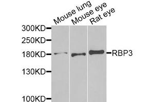 Western blot analysis of extracts of various cells, using RBP3 antibody. (RBP3 antibody)