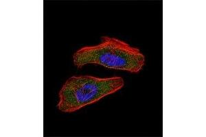 Fluorescent confocal image of HeLa cell stained with HIF1 alpha antibody at 1:25. (HIF1A antibody  (AA 1-30))
