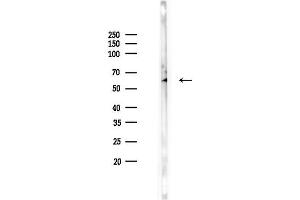 Western blot analysis of lysates from Rat testis, using FTO Antibody at 1/1000 dilution.