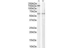 Western Blotting (WB) image for anti-Signal-Induced Proliferation-Associated 1 (SIPA1) (C-Term) antibody (ABIN2466269) (SIPA1 antibody  (C-Term))