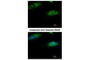 ICC/IF Image Immunofluorescence analysis of methanol-fixed HeLa, using Ribophorin I, antibody at 1:500 dilution. (RPN1 antibody  (C-Term))