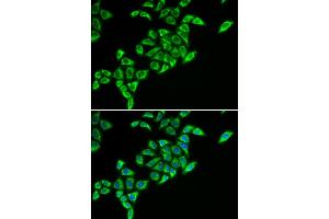 Immunofluorescence (IF) image for anti-Dihydrolipoyl Transacetylase (DLAT) antibody (ABIN1980304) (DLAT antibody)