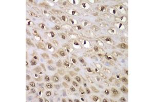 Immunohistochemistry of paraffin-embedded human esophagus using INTS5 antibody  at dilution of 1:100 (40x lens). (INTS5 antibody  (AA 120-400))