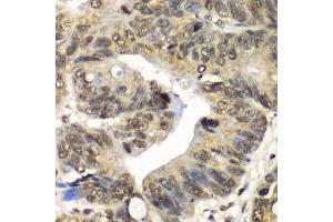 Immunohistochemistry of paraffin-embedded human colon using UFD1L antibody at dilution of 1:100 (x40 lens). (UFD1L antibody)