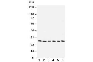 Western blot testing of ARC antibody and human samples 1:  SMMC-7721 (NOL3 antibody  (AA 91-106))