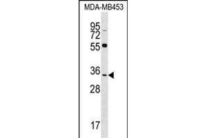 FKBP6 Antibody (C-term) (ABIN1536953 and ABIN2848611) western blot analysis in MDA-M cell line lysates (35 μg/lane).