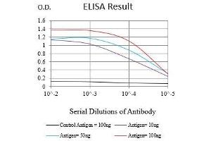 Black line: Control Antigen (100 ng),Purple line: Antigen (10 ng), Blue line: Antigen (50 ng), Red line:Antigen (100 ng) (Ki-67 antibody  (AA 1160-1493))