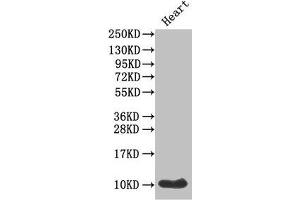Western Blot Positive WB detected in: Mouse heart tissue All lanes: IAPP antibody at 1 μg/mL Secondary Goat polyclonal to rabbit IgG at 1/50000 dilution Predicted band size: 10 kDa Observed band size: 10 kDa (Amylin/DAP antibody  (AA 34-70))