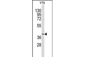 Western blot analysis of anti-AKR1A1 Antibody (C-term) (ABIN389204 and ABIN2837921) in Y79 cell line lysates (35 μg/lane). (AKR1A1 antibody  (C-Term))