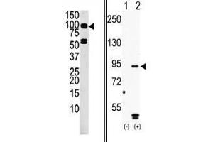 (LEFT)Western blot analysis of anti-MARK4 Pab in mouse liver tissue lysate (35ug/lane). (MARK4 antibody  (C-Term))