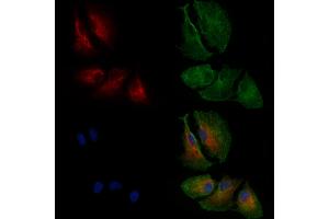 ABIN6261634 and ABIN6269150 staining  cells by IF/ICC.