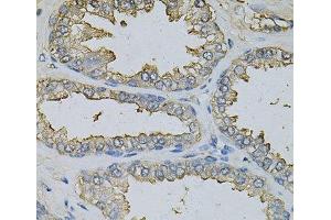 Immunohistochemistry of paraffin-embedded Human prostate using DBI Polyclonal Antibody at dilution of 1:100 (40x lens). (Diazepam Binding Inhibitor antibody)