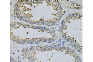 Immunohistochemistry of paraffin-embedded Human prostate using DBI Polyclonal Antibody at dilution of 1:100 (40x lens).