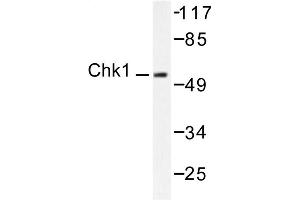 Image no. 1 for anti-Checkpoint Kinase 1 (CHEK1) antibody (ABIN265347) (CHEK1 antibody)