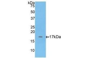 Detection of Recombinant ADAMTS7, Rat using Polyclonal Antibody to A Disintegrin And Metalloproteinase With Thrombospondin 7 (ADAMTS7) (ADAMTS7 antibody  (AA 444-575))