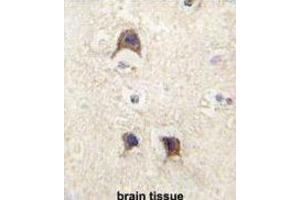 Immunohistochemistry (IHC) image for anti-Leucine-Rich Repeat Containing G Protein-Coupled Receptor 5 (LGR5) (Loop 2) antibody (ABIN2937468) (LGR5 antibody  (Loop 2))