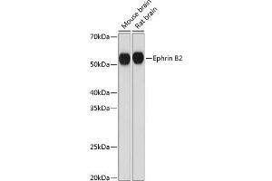 Western blot analysis of extracts of various cell lines, using Ephrin B2 Rabbit mAb (ABIN7266978) at 1:1000 dilution. (Ephrin B2 antibody)