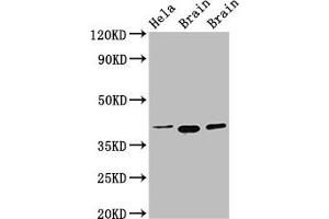 Western Blot Positive WB detected in: Hela whole cell lysate, Rat brain tissue, Mouse brain tissue All lanes: ERGIC2 antibody at 2.
