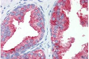 Immunohistochemistry (Paraffin-embedded Sections) (IHC (p)) image for anti-Nuclear Receptor Subfamily 1, Group I, Member 3 (NR1I3) (AA 180-229) antibody (ABIN462245)