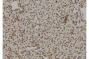 ABIN6269157 at 1/100 staining Rat kidney tissue by IHC-P.