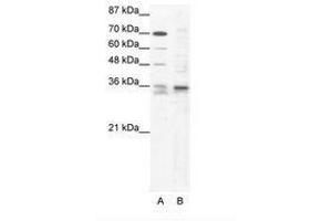 Image no. 1 for anti-SRY (Sex Determining Region Y)-Box 12 (SOX12) (C-Term) antibody (ABIN202223) (SOX12 antibody  (C-Term))