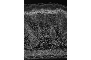 HIF1alpha (EP190b), Mosue backskin. (HIF1A antibody  (AA 329-530))