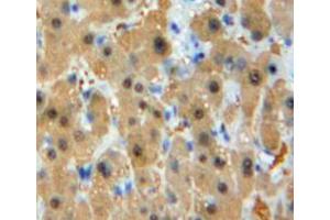IHC-P analysis of liver tissuev, with DAB staining. (GSTM1 antibody  (AA 1-218))