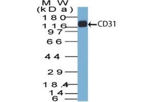 Western Blot of CD31 in THP-1 lysate using CD31 Mouse Monoclonal Antibody (C31.