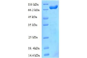 NrdD (AA 1-712), (full length) protein (His tag)