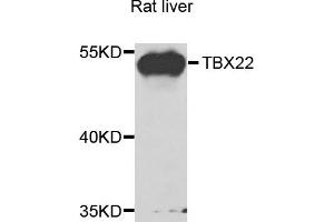 Western blot analysis of extracts of rat liver cells, using TBX22 antibody. (T-Box 22 antibody)