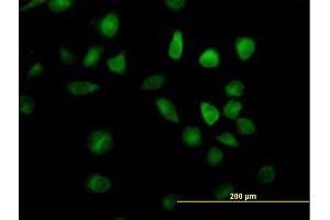 Immunofluorescence of purified MaxPab antibody to RAP1GDS1 on HeLa cell. (RAP1GDS1 antibody  (AA 1-607))